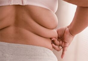 Fat folds on the sides